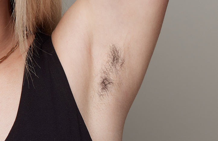 The effect of using ulike air 10 before underarm hair removal