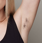 The effect of using ulike air 10 before underarm hair removal